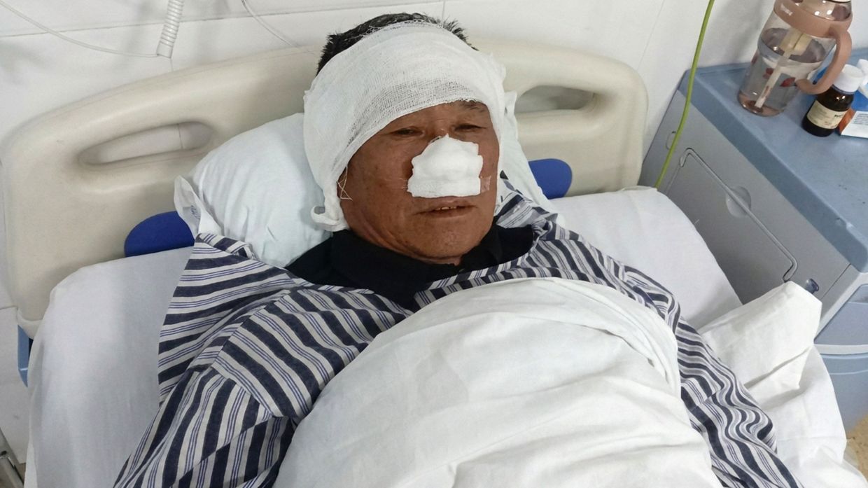 Chinese village mediator recognised as national hero after losing nose to save woman from attacker