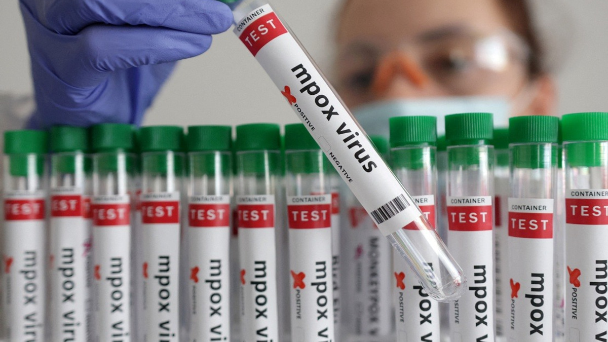 Guinea-Bissau Confirms First Mpox Case as Health Authorities Activate Emergency Response