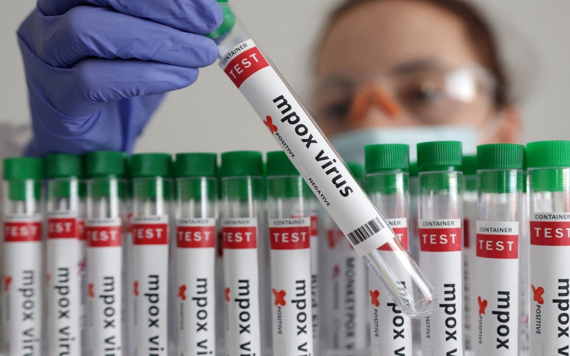 Guinea-Bissau Confirms First Mpox Case as Health Authorities Activate Emergency Response