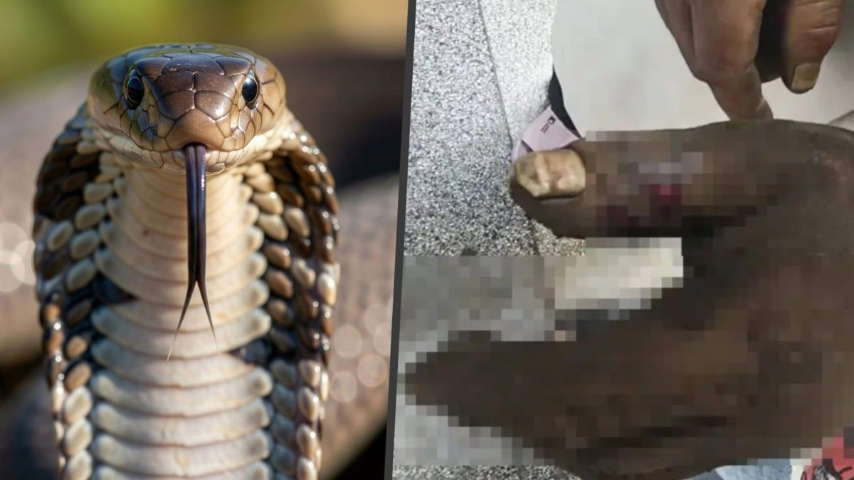 Wife's well-intentioned venom-sucking rescue backfires, poisoning herself after cobra strikes husband in China