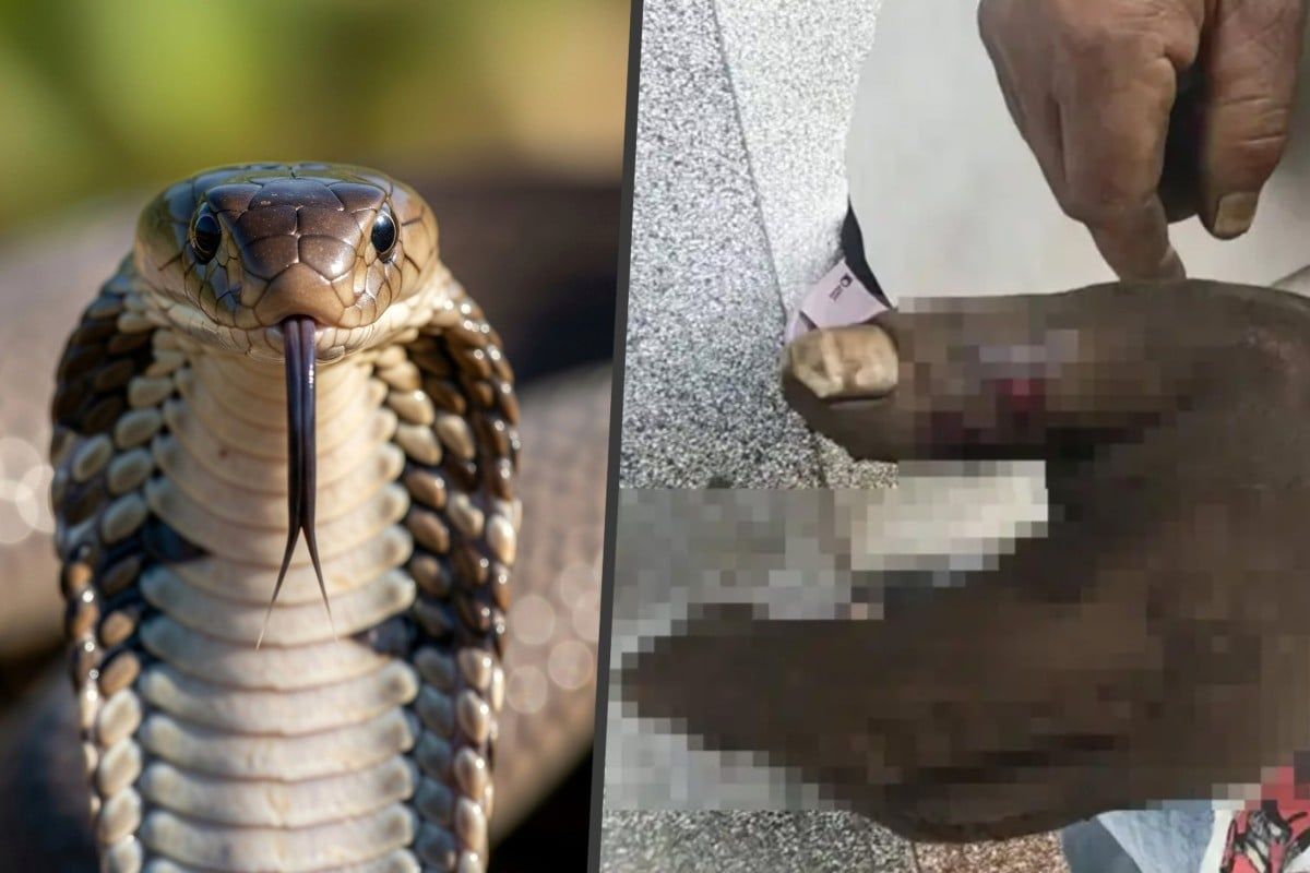 Wife's well-intentioned venom-sucking rescue backfires, poisoning herself after cobra strikes husband in China