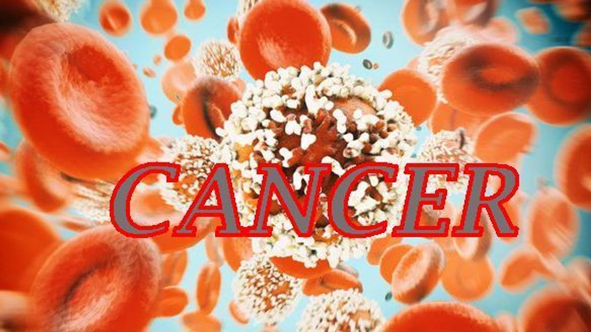 The Silent Threat: Why Young People Must Not Ignore Colorectal Cancer Warnings